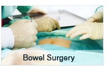 Bowel Surgery